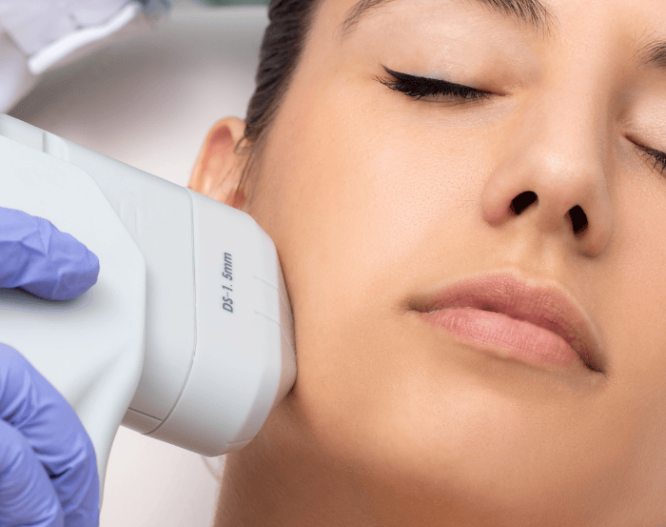 hifu-2 HIFU Skin Tightening in Santa Clara, CA