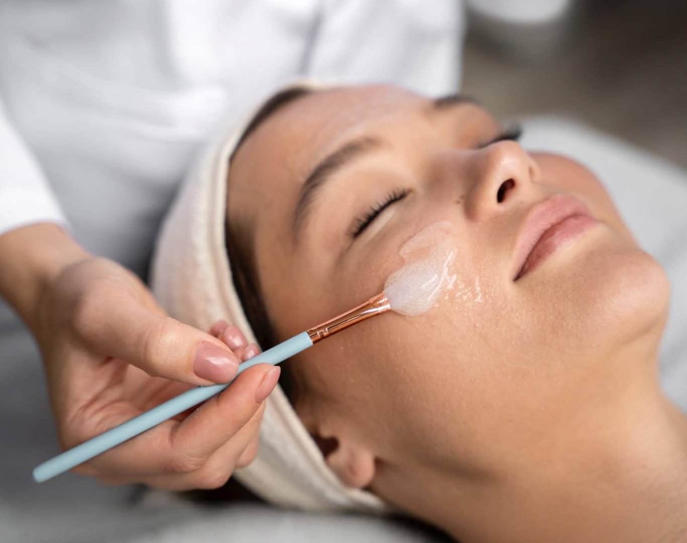 peels-clara-2 Chemical Peels Near Me