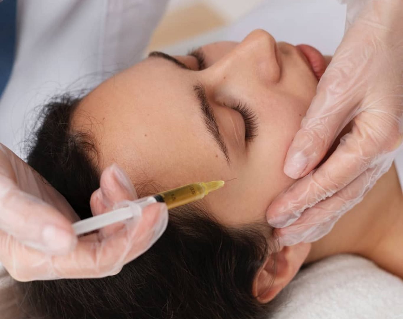 prp-1 PRP (Platelet-Rich Plasma) in Santa Clara, CA